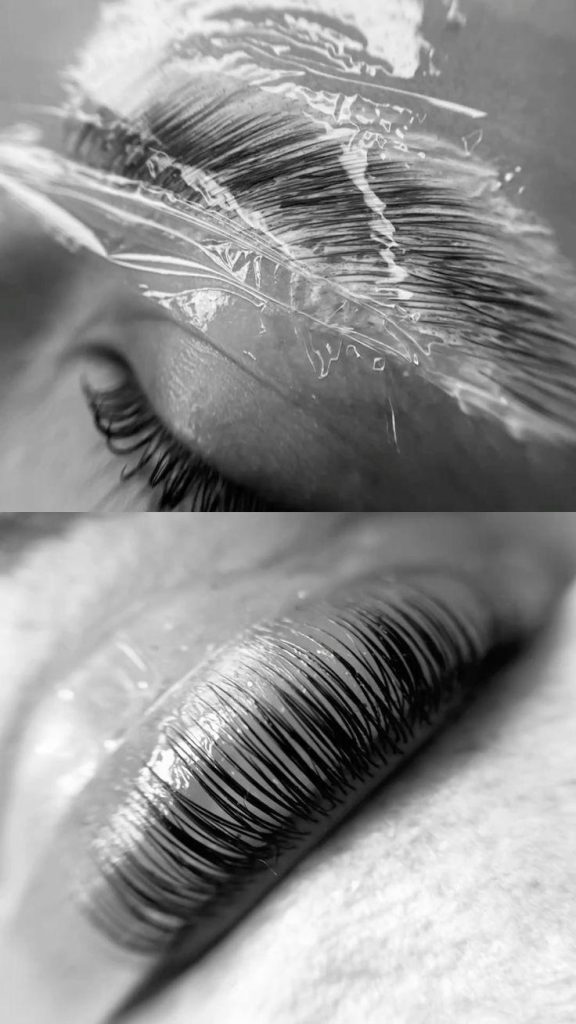 augenbraunlifting2 augenbraunlifting2